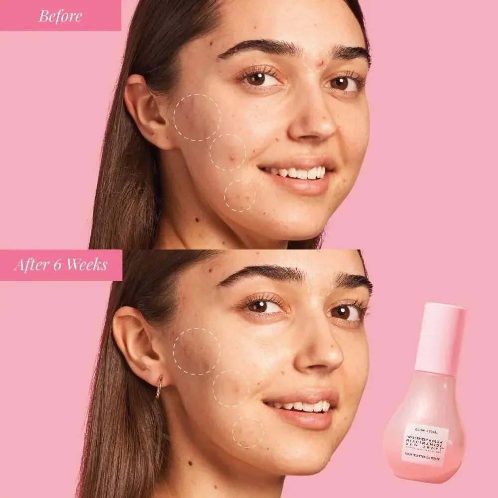 Glow Recipe Watermelon Glow Niacinamide Dew Drops Brightening Serum